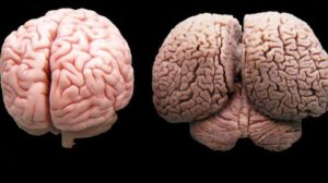 مقارنة بين دماغ الإنسان والدولفين